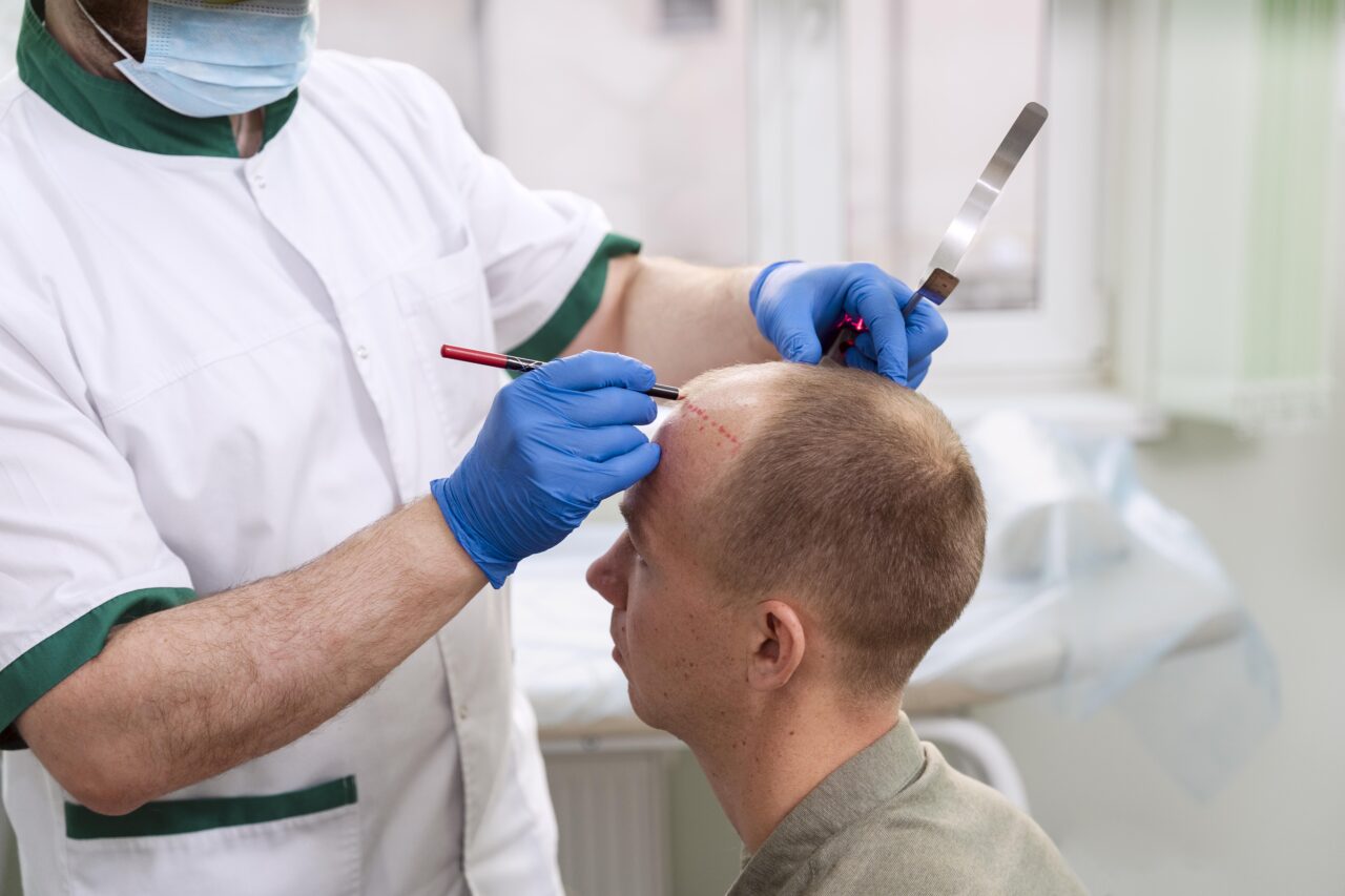 https://germanaesthetic.net/wp-content/uploads/2025/02/adult-male-having-balding-problems-1280x853.jpg